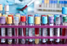 Alterazioni nel sangue dei vaccinati – Nessuno studio scientifico è in grado di smentire (Così interviene il PD con la propaganda “di pancia”)